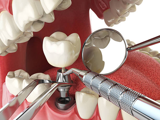 Best Orthodontic Emergency Dentist in Fredericksburg, PA